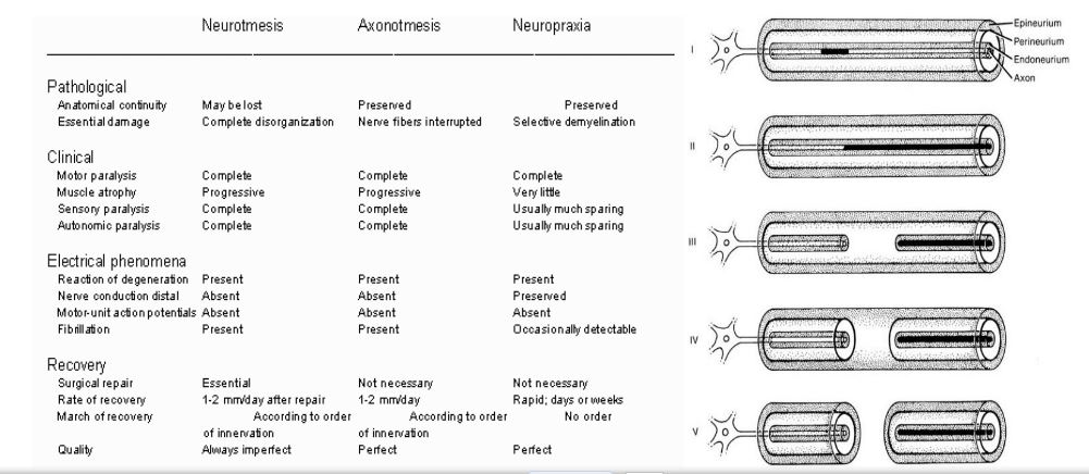 nerve-regeneration